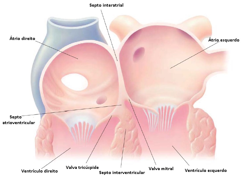 Corte transversal dos ventrículos, com evidente hipertrofia do